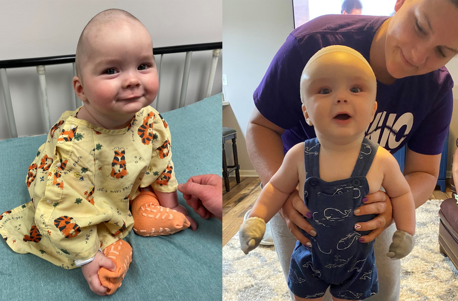 Rhett before and after surgery