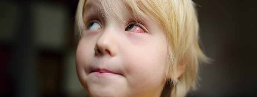 Blonde child with eye irritation.