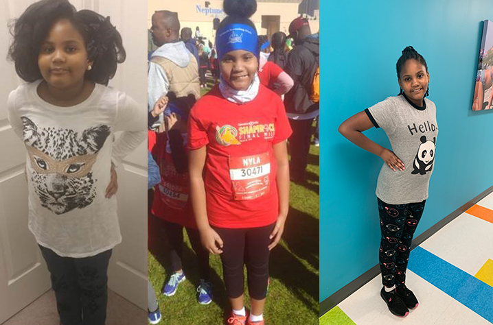 Young girl showing before and after of her weight loss journey.