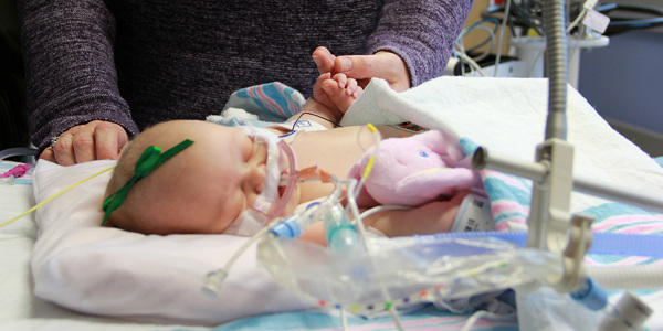 ECMO2 CHKD