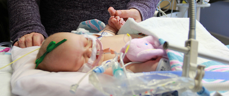 ECMO2 CHKD
